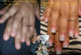 /album/nails/antes-e-depois3-png/
